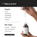 Shop Minimalist 2% Salicylic Acid Face Serum For Blackheads & Whiteheads (30ml)
(30ml) Online in India Chennai Tamil Nadu / Review