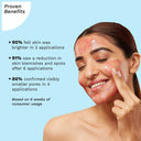Buy Pilgrim 25% AHA 2% BHA 5% PHA Face Peeling Solution for Acne Scars (30ml) Online in India