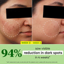 Dot & Key 10% Niacinamide + Cica Face Serum For Oily, Acne Prone Skin & Dark Spots Reduction