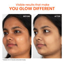 Foxtale SPF 50 Aqua-Gel Lightweight Sunscreen for Oily Skin, In-Vivo Tested PA++++, Matte Finish (50gm)
