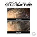 L'Oreal Paris Fall Resist 3x Shampoo For Anti-Hairfall