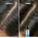 L'Oreal Professionnel Scalp Advanced 5-In-1 Leave-In Hair Serum (90ml)