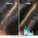 L’Oréal Professionnel Scalp Advanced Anti-Oiliness Shampoo for Oily Scalp, Less scalp sebum, 3% AHA (300ml)