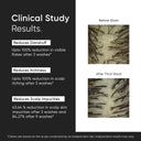 Minimalist Anti-Dandruff Shampoo 3.5% Salicylic Acid For Flaky & Itchy Scalp, Gentle & Sulphate-Free (200ml)