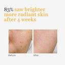 O3+ Skin Solutions Vitamin C Serum Glow With Glycolic Acid (30ml)