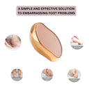OROSSENTIALS Foot Scrapeer for Dead Skin (ORO-025)