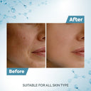 Raaga Professional De-Tan Tan Removal Cream