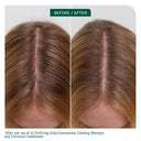 Biolage Scalp Sync Anti-Dandruff Concentrate, Exfoliating & Clarifying Dry Scalp Treatment (200ml)