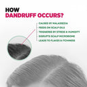 Sebamed Anti-Dandruff Shampoo, pH 5.5Ipiroctone Olamine Fights Dandruff Causing Fungii (200ml)