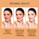 Vedic Valley Vitamin C Face Serum (30ml)