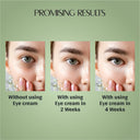 Vedic Valley Phyto Retinol Under Eye Cream (30ml)