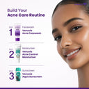 Venusia Acne Facewash With Sebum Control & Hydrating Formula (75gm)