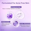 Venusia Dr. Reddy's Acne Moisturizing Gel (60gm)