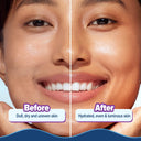 Aqualogica Illuminate + Hydra Gel Moisturizer with Alpha Arbutin for 24 Hour Intense Hydration (200gm)