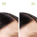 Matrix Biolage Scalppure Professional Anti-Dandruff Shampoo, Removes Visible Flakes After 1st Wash