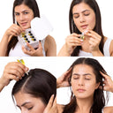 Itchy Scalp to Fights Dandruff (48ml) Online in India Chennai Tamil Nadu / Review