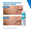  Reduces Acne Marks with Licorice Root Extract & Niacinamide (30ml) reviews. COD