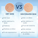 Cetaphil Optimal Hydration Body Lotion With Hyaluronic Acid+Vitamin E For Dehydrated Skin
(237ml)