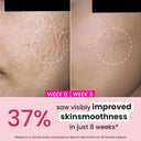 Buy Dot & Key Products at the lowest price from Pixies.in. Check out Dot & Key Retinol + Ceramide Sleep Treatment Anti-Ageing Night Cream For Fine Lines & Wrinkles (60ml) reviews. COD