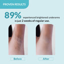  Reduces Pigmentation & Odour for Women & Men (60ml) Online in India