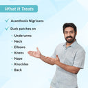  Knuckles & Elbows (100gm) Online in India