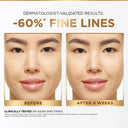 L'Oreal Paris Revitalift Serum, Hydrating and Plumping, Replumps Skin in 1H, Reduces Fine Lines