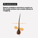 Buy L'Oreal Professionnel Scalp Advanced Anti Oiliness Dermo Purifier Shampoo For Oily Scalp (300ml) Online in India