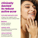  Acne Breakouts (100ml) Online in India Chennai Tamil Nadu / Review