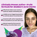 Plix 10% Niacinamide Jamun Face Serum for Acne marks, blemishes & oil control (30ml)