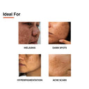 Shop Fixderma 10% Tranexamic Acid + 2%Kojic Acid + 1%Arbutin SKARFIX TX Face Cream For Pigmentation (15gm) Online in India Chennai Tamil Nadu / Review