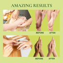 vedic-valley-de-tan-vitamin-a-manicure-and-pedicure-kit-apple-honey-monodose-75gm